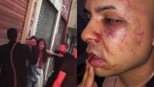 video:-patovicas-de-un-boliche-de-tucuman-atacaron-con-latigazos-y-pinas-a-una-pareja-de-jovenes